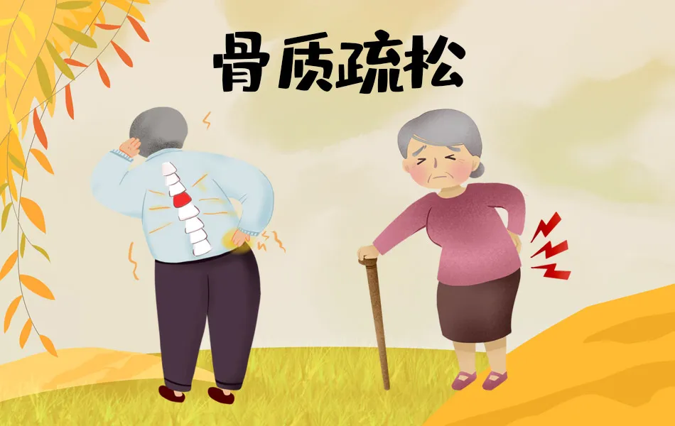 哪類人群更容易得骨質(zhì)疏松