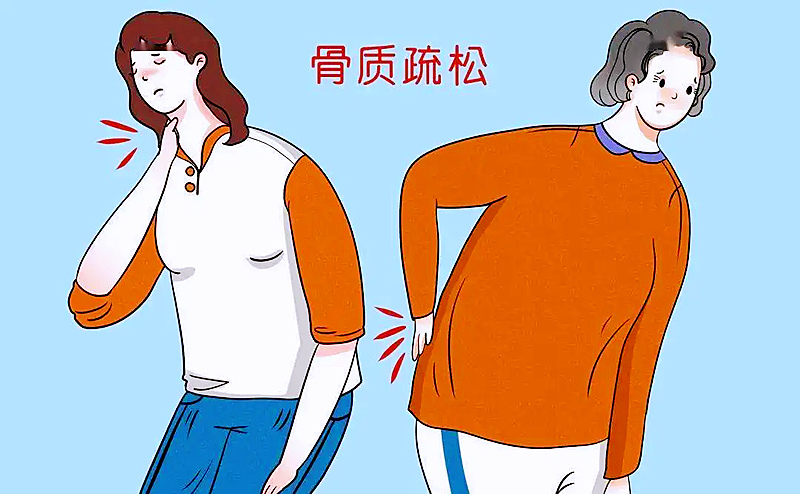 使用骨密度儀判斷骨質(zhì)疏松的風(fēng)險(xiǎn)